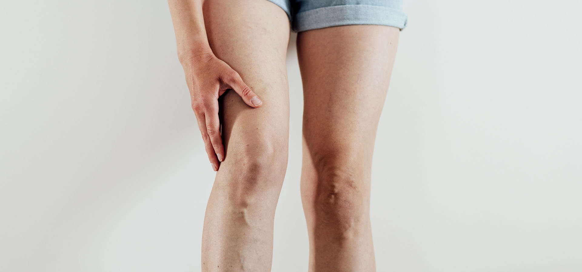 Eine Frau hält ihr Bein auf Kniehöhe - ein Bild, das die Bedeutung von Omega-3 in der Thromboseprävention hervorhebt.